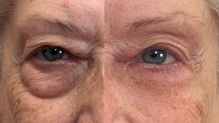 Get Rid of Eye Bags Instantly Eliminate Puffiness and Darkness 🚨 Fierce Aging with Nikol Johnson [upl. by Eppesuig]