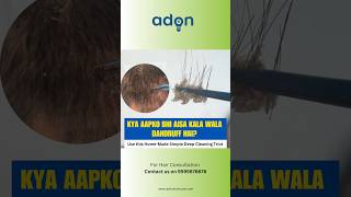 Deep Cleaning HomeMade Simple Trick For Hair Regrowth AdonHairCare hairregrowthtips viral [upl. by Labinnah520]