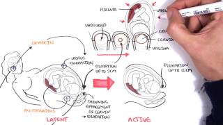 Obstetrics  Stages of Labour [upl. by Ynitsed181]