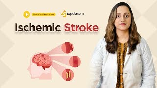 Ischemic Stroke  Neurology Medicine Lecture for Medical Students Online Education [upl. by Arocahs736]