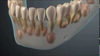 Denticao decidua e permanente [upl. by Schram]