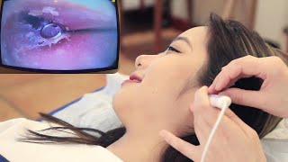 【ASMR】Experience the most professional visual ear cleaning Dig earwax relax ear massage [upl. by Shelba836]