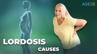 Causes of Lordosis  Why is my Back so Arched  Restore Your Neck Posture amp Curve [upl. by Rana614]