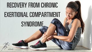 Recovery from chronic exertional compartment syndrome CECS [upl. by Ailec]