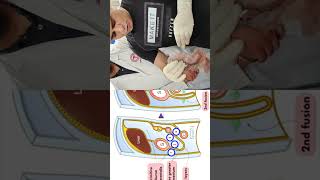 Layers of the greater omentum shorts anatomy biology [upl. by Delgado]