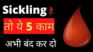 sickling है तो ये 5 काम अभी बंद कर दोSickle cell anemia [upl. by Quinlan801]