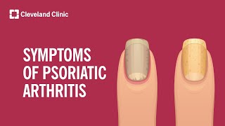 7 Signs of Psoriatic Arthritis [upl. by Suzette]