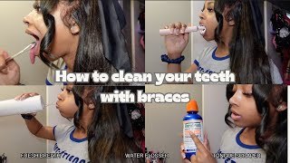 HOW TO CLEAN YOUR TEETH WITH BRACES  My Routine 😬✨ [upl. by Kosse]