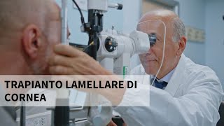 Il trapianto lamellare di cornea  Parliamo con il Prof Luigi Fontana [upl. by Seilenna]