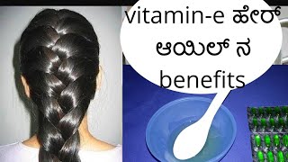 vitamin e ಹೇರ್ ಆಯಿಲ್ ಉಪಯೋಗಿಸುವುದು ಹೇಗೆhair tips for growing long hair [upl. by Niel538]