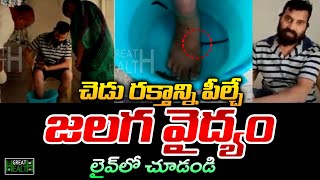 Leech Treatment In Live  Dr Gummadavelli Srinivas  Leech Therapy  Telugu70mm [upl. by Ferrick523]