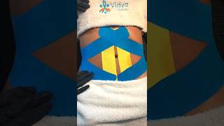 Técnica Kinesiotaping 💆🏻‍♀️✨ estetica kinesiotape esteticista fisioterapia [upl. by Ahsea]