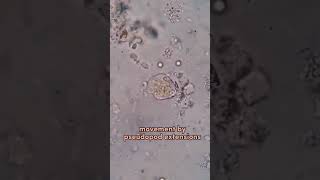 entamoeba histolytica pseudopodia locomotion through pseudopodia [upl. by Ecnarwal]