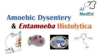 Amebiasis Amoebic Dysentery  Entamoeba histolytica Pathogenesis Signs amp Symptoms Treatment [upl. by Arquit372]