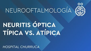 NEURITIS ÓPTICA TÍPICA VS ATÍPICA [upl. by August]