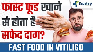 फास्ट फूड खाने से होता है सफेद दाग Junk Food in Vitiligo  Kayakalp Gloabal  Safed daag ki ilaag [upl. by Dijam462]