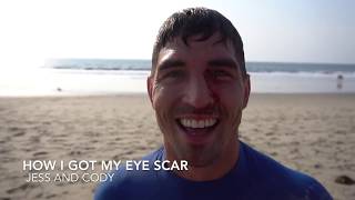 How I Got My Eye Scar  Jess and Cody [upl. by Yroc]