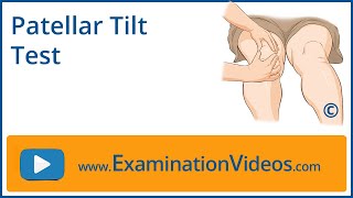 Patellar Tilt Test [upl. by Pollock]