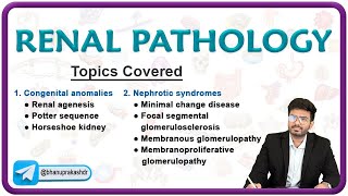 🌟 Exploring Renal Pathology Congenital Anomalies amp Nephrotic Syndromes 🌊 [upl. by Bing]