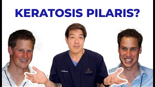 Keratosis Pilaris  How to treat by dermatologist Dr Davin Lim [upl. by Deidre]