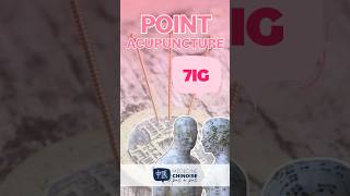 POINT D’ACUPUNCTURE  7IG  Zhi Zheng acupuncture acupuncturepoints medecinechinoise [upl. by Enybor244]