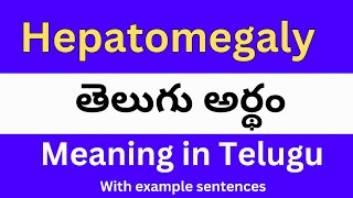 Hepatomegaly meaning in telugu with examples  Hepatomegaly తెలుగు లో అర్థం Meaning in Telugu [upl. by Malissa]