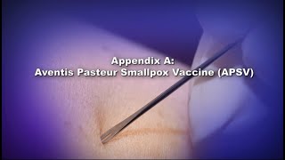 Appendix A Aventis Pasteur Smallpox Vaccine APSV [upl. by Vincenty]