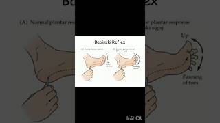 Babinski reflex viralshort medicaleducation humanbody allaboutnorcet norcetstudytips motiv [upl. by Blane96]