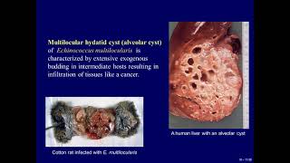 18 Medical Parasitology Cestodes [upl. by Enamrahc]