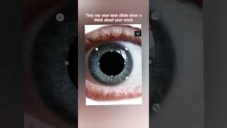 Dilating eyes  Watch the Related video [upl. by Grizelda]