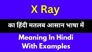 X Ray meaning in HindiX Ray का अर्थ या मतलब क्या होता है [upl. by Bertila513]