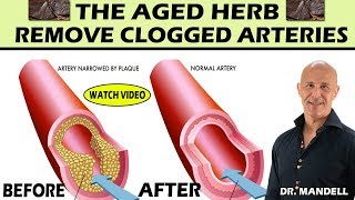 THE AGED HERBREMOVE CLOGGED ARTERIES LOWER CHOLESTEROL amp BLOOD PRESSURE  Dr Alan Mandell DC [upl. by Merri495]