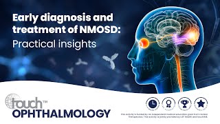 Early diagnosis and treatment of NMOSD Practical insights [upl. by Reede]