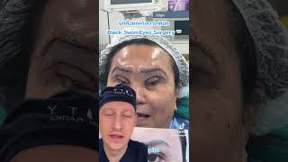 Shocking Black Swan Eye Surgery Trend  Plastic Surgeon Reacts [upl. by Mathilda]