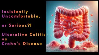 Ulcerative Colitis vs Crohns Disease [upl. by Gardel639]