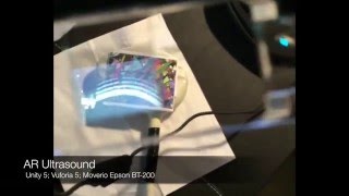 Ultrasound AR with Digital Eyewear [upl. by Eelsew168]