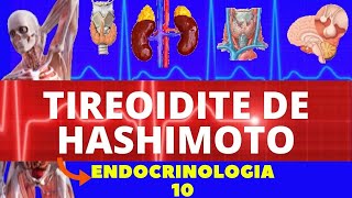 TIREOIDITE DE HASHIMOTO CAUSAS SINTOMAS DIAGNÓSTICO E TRATAMENTO  ENDOCRINOLOGIA [upl. by Hafeetal970]