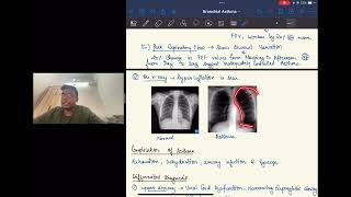 BRONCHIAL ASTHMA For University Studentsl Dr Sahil Bansal [upl. by Proctor]