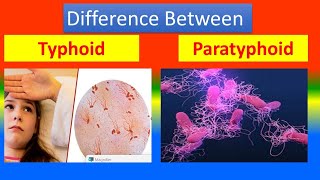 Distinction between Typhoid and Paratyphoid [upl. by Icken]