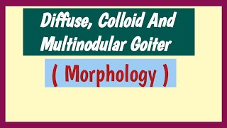 Diffuse Colloid And Multinodular Goiter  Pathology Morphology [upl. by Maje38]