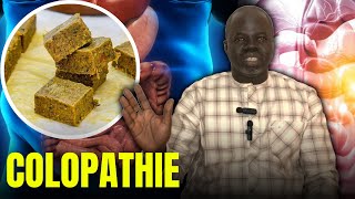 Colopathie 1   Causes et Conséquences   Pr Ousmane Ndiaye  SAMA XALAAT TV [upl. by Heiner292]