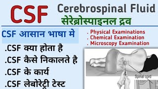 CSF cerebrospinal fluid physical examination collection of csf CSF laboratory testKiran maurya [upl. by Marlane]