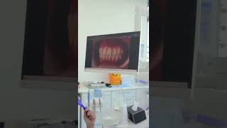 Cementation Dr Turab at Queens Medical Center  Dubai UAE [upl. by Onibla]