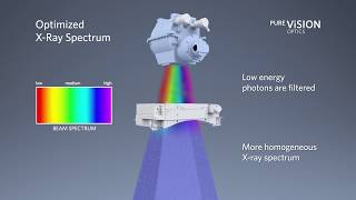 CT PUREViSION Optics  Transforming CT [upl. by Rockel460]