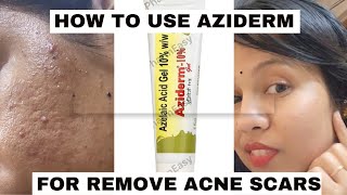 aziderm gel review honest reviewhow to use azelaic acid for acne amp acne marksacnetreatment viral [upl. by Aroda]