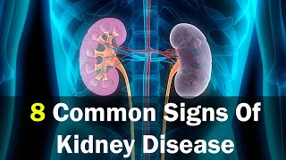 8 Signs You Might Have a Kidney disease  Kidney Failure Symptoms [upl. by Suzann]