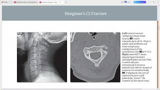 SPINE IMAGING DIAGNOSTIC IMAGING SERIES [upl. by Felske266]