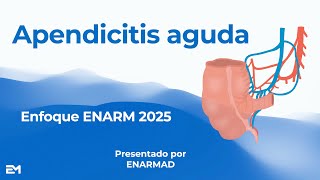 Apendicitis aguda para ENARM 2025 [upl. by Memberg172]