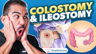 Colostomy and Ileostomy Nursing  Indications Complications Care EASY [upl. by Elime664]