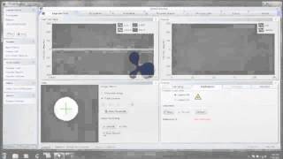 ICS Impulse  Pupil Detection [upl. by Suzi]